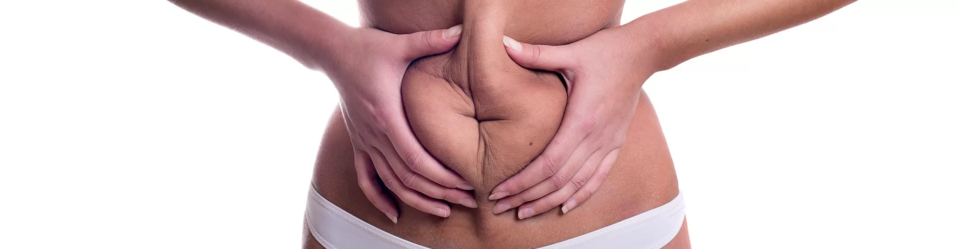 Tummy Tuck