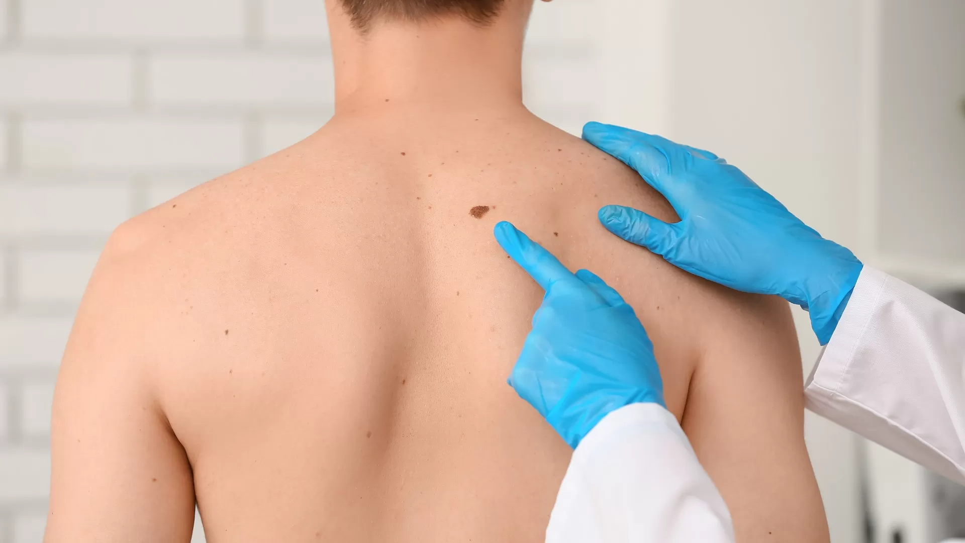 Dermatology